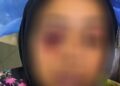 الاعتداء على أخصائية تمويل بإحدى شركات التمويل متناهي الصغر اثناء تأدية عملها وتحصيل الأقساط من العملاء بمحافظة دمياط